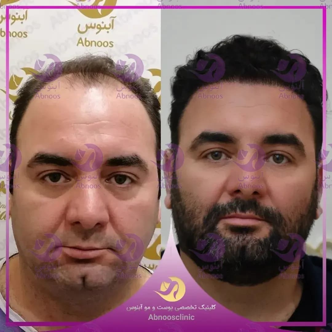 جدید‌ترین نمونه کار‌ها