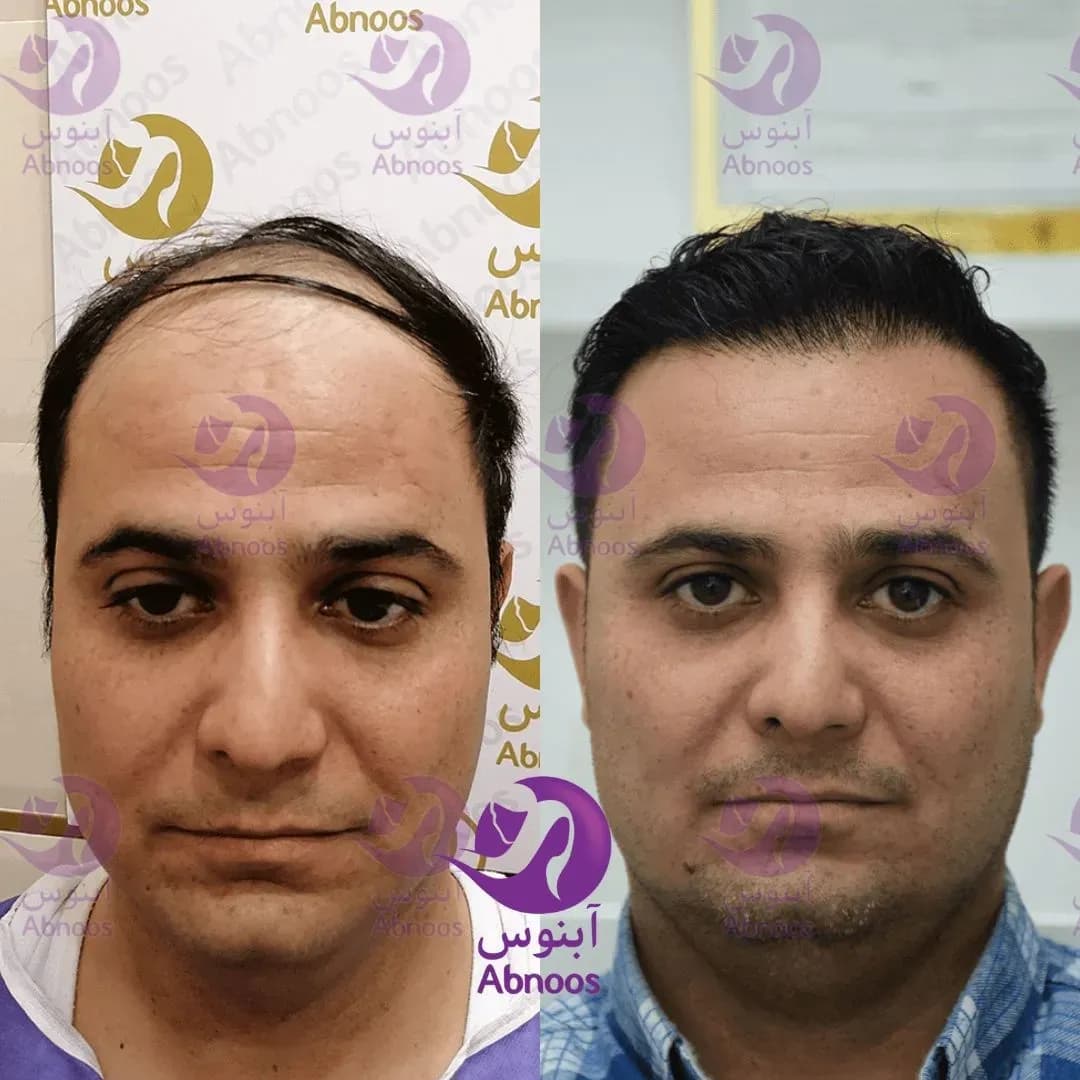 جدید‌ترین نمونه کار‌ها